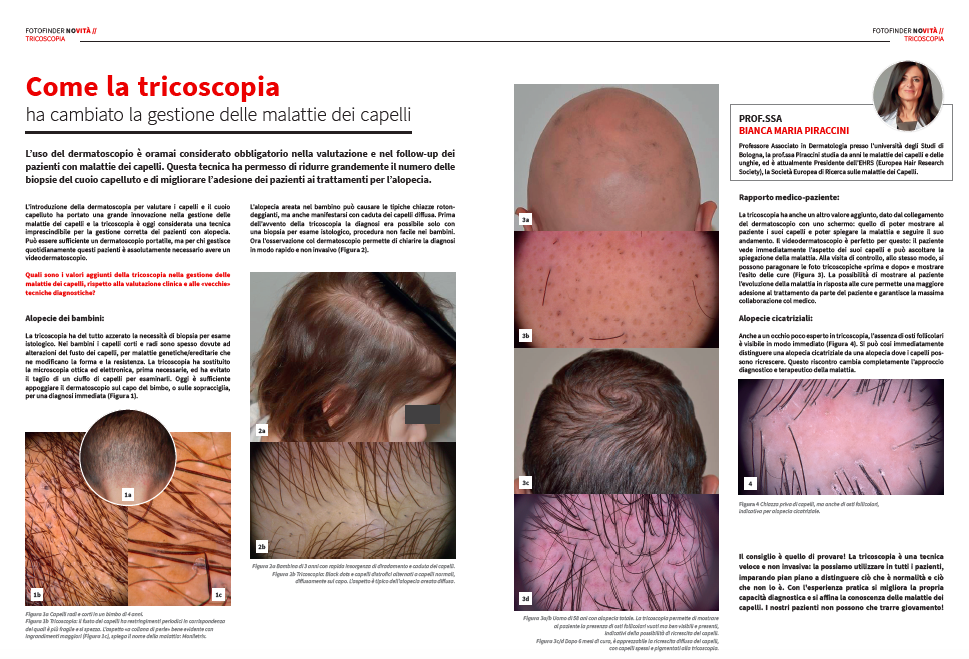articolo della dottoressa piraccini sulla tricoscopia